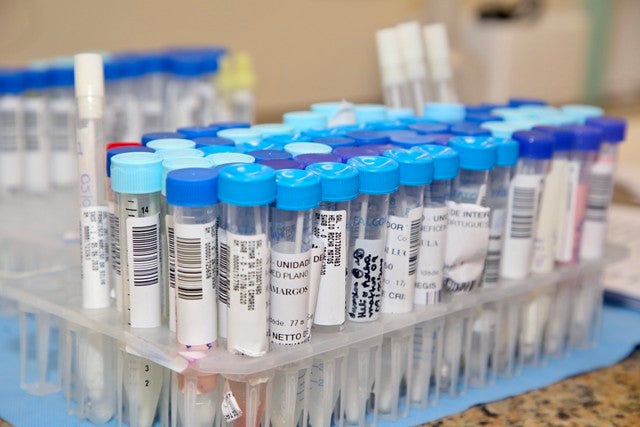 54% do total de infectados pelo Covid-19 no Brasil estão recuperados