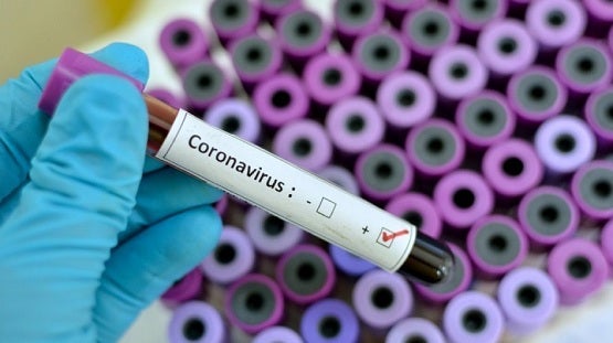 Itália registra 919 novas mortes, maior número diário desde início da pandemia do coronavírus