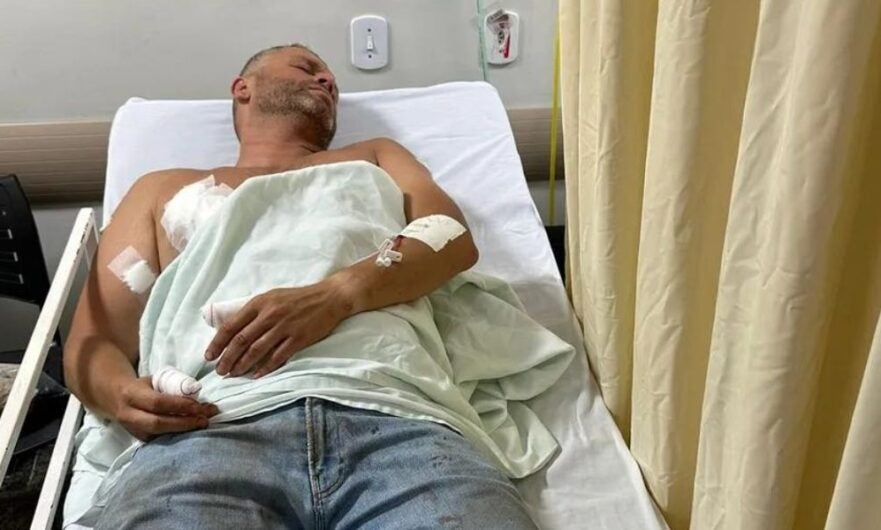 Prefeito de cidade no RJ é atacado por pitbull ao tentar ajudar vizinho e está hospitalizado
