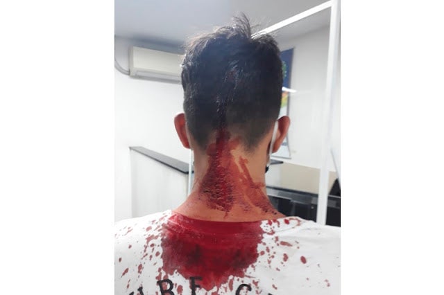 Guarda Municipal de Juazeiro detém em flagrante homem que atingiu ex-esposa e atual namorado com golpes de martelo