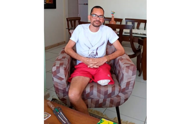 Professor de Petrolândia comemora sucesso de cirurgia para amputação da perna e reforça apelo por prótese [Vídeo]