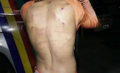 Homem é torturado e abusado sexualmente por ex-sócio em Pernambuco