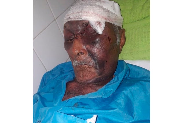 Idoso de 83 anos é agredido com golpes de faca e pedradas durante tentativa de roubo em Petrolândia; acusada do crime foi presa pela PM