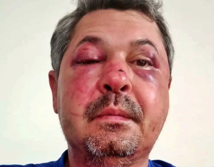 Pernambucano é agredido em Portugal por homem que perguntou sua nacionalidade