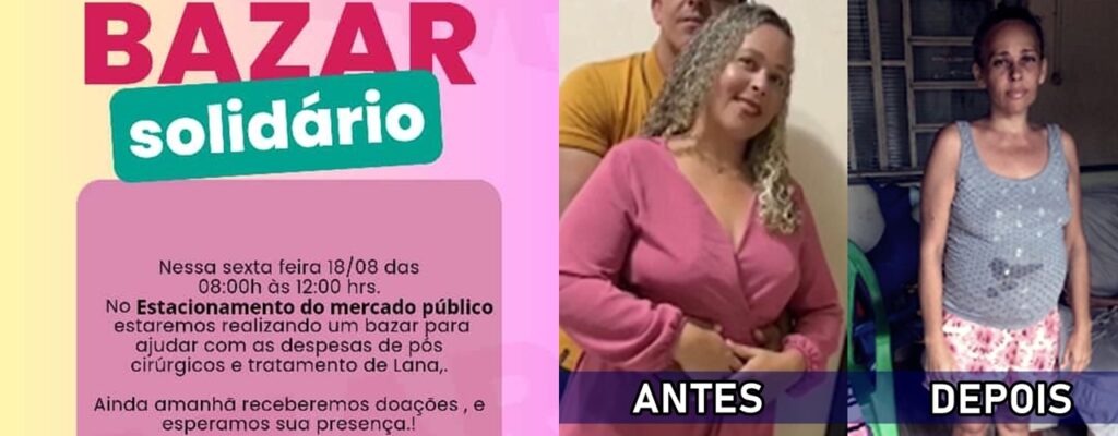 Atenção Petrolândia: Bazar Solidário para ajudar com as despesas de pós cirúrgicos e tratamento de Lana é realizado nesta sexta (18)