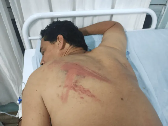 Em Pernambuco, ex-prefeito é sequestrado e espancado a três dias das eleições municipais Em Pernambuco, ex-prefeito é sequestrado e espancado a três dias das eleições municipais