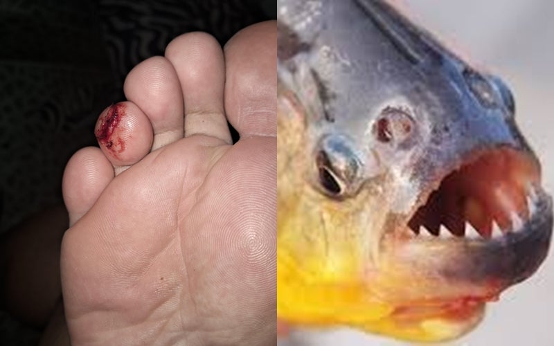 “Teve que ir para o hospital levar ponto”, diz mãe de jovem atacado por peixe-pirambeba na prainha de Petrolândia-PE