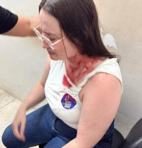 Candidata a deputada pelo PSOL é atacada em Ouricuri, no Sertão de PE Candidata a deputada pelo PSOL é atacada em Ouricuri, no Sertão de PE