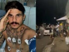 PM baleado na cabeça por colega durante ocorrência em Água Preta celebra recuperação:‘‘O Senhor me sustentou’’